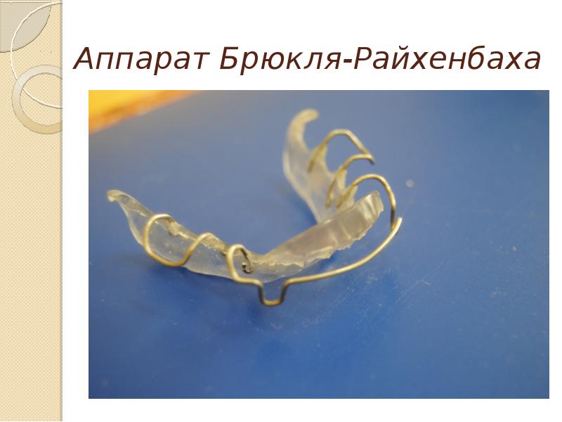 Ортодонтические аппараты презентация