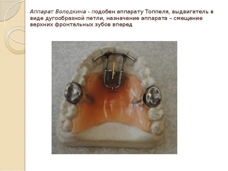 Съемные ортодонтические аппараты презентация