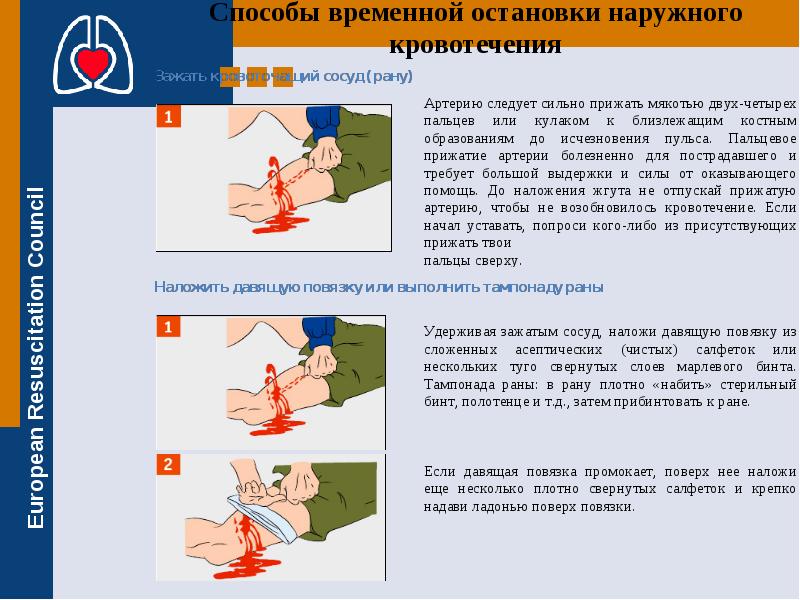 Давящая повязка какое кровотечение. Давящая асептическая повязка. Повязка давящая с тампонадой. Давящая повязка при кровотечении. Когда следует накладывать давящие повязки.