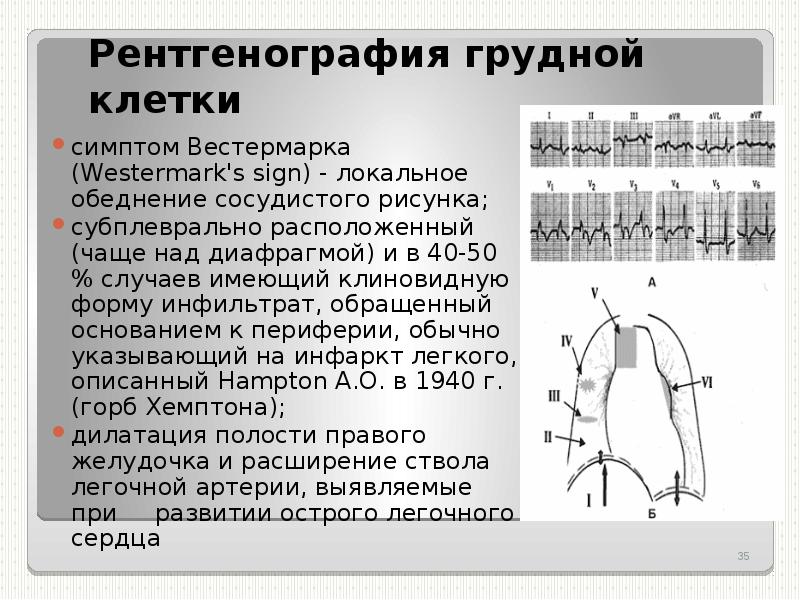 Рентген картина тэла