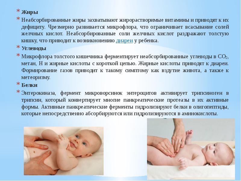 Склередема новорожденных презентация