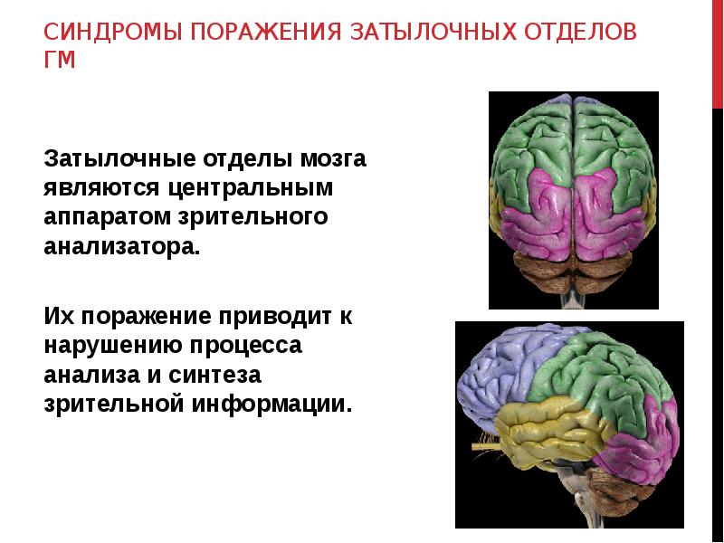 Нарушение поражение мозга. Нейропсихологические синдромы поражения затылочных отделов мозга. Синдром поражения теменно- затылочных отделов. Синдромы поражения затылочных и затылочно-теменных отделов мозга.. Синдромы поражения теменно-затылочных отделов головного мозга.