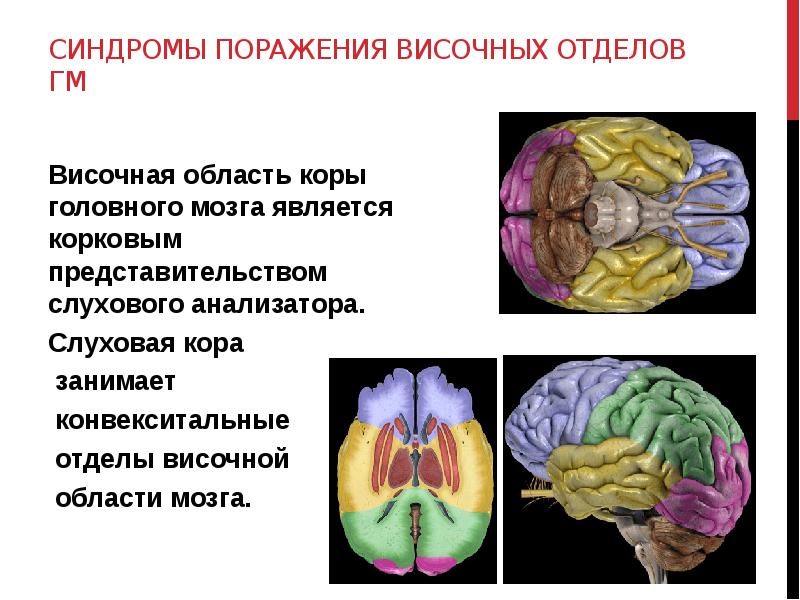 Головной мозг синдромы. Слуховая кора головного мозга. Поражение конвекситальных отделов лобных долей мозга. Синдромы поражения лобных долей мозга. Синдром поражения лобной доли головного мозга.