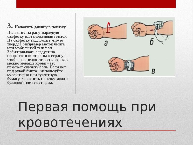 Наложение повязки при кровотечении