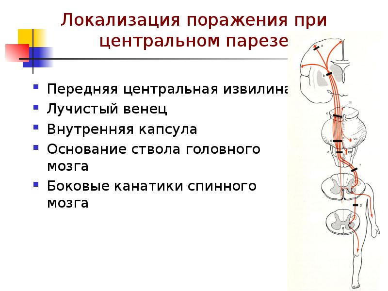 Центральный и периферический паралич презентация