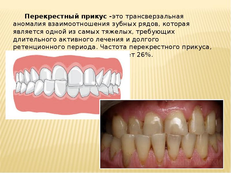 Презентации по ортодонтии