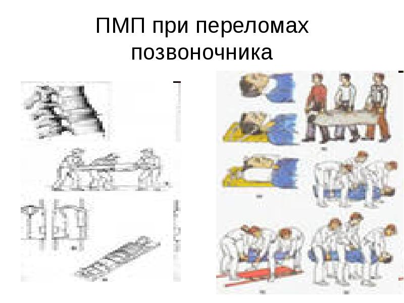 Лфк при повреждении позвоночника презентация