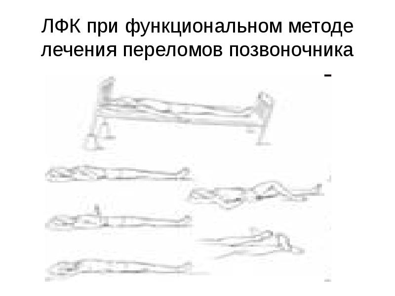 Презентация сестринский уход при травмах позвоночника