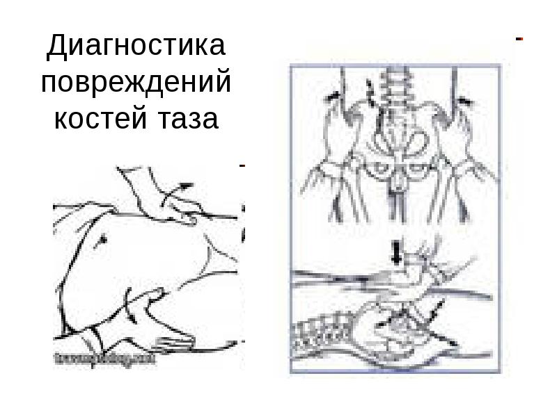 Презентация сестринский уход при травмах позвоночника