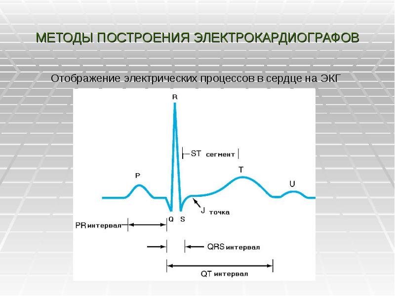 Электрические процессы. Построение электрокардиографа. Электрические процессы в сердце. Графическая запись электрических процессов сердца. Метод электрических отображений.