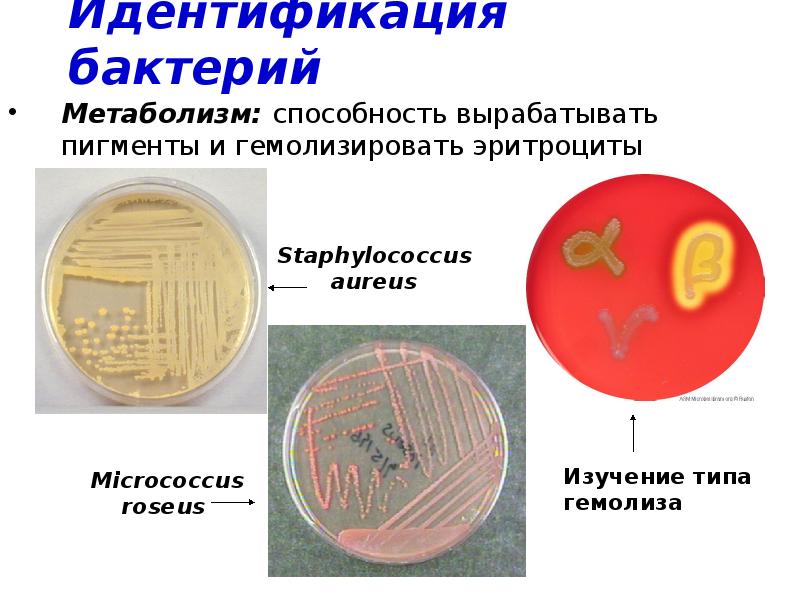 Свойства идентификации бактерий. Идентификация бактерий. Методы идентификации микроорганизмов. Идентификация выделенной чистой культуры бактерий. Методы изучения метаболизма бактерий.
