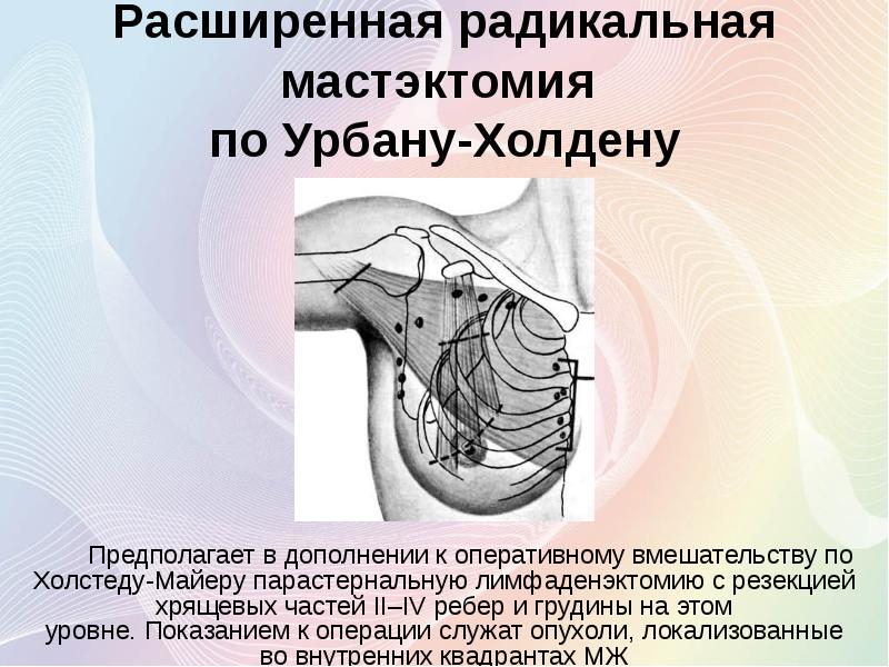 Рак молочной железы лечение презентация