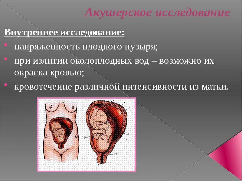 Акушерские кровотечения презентация