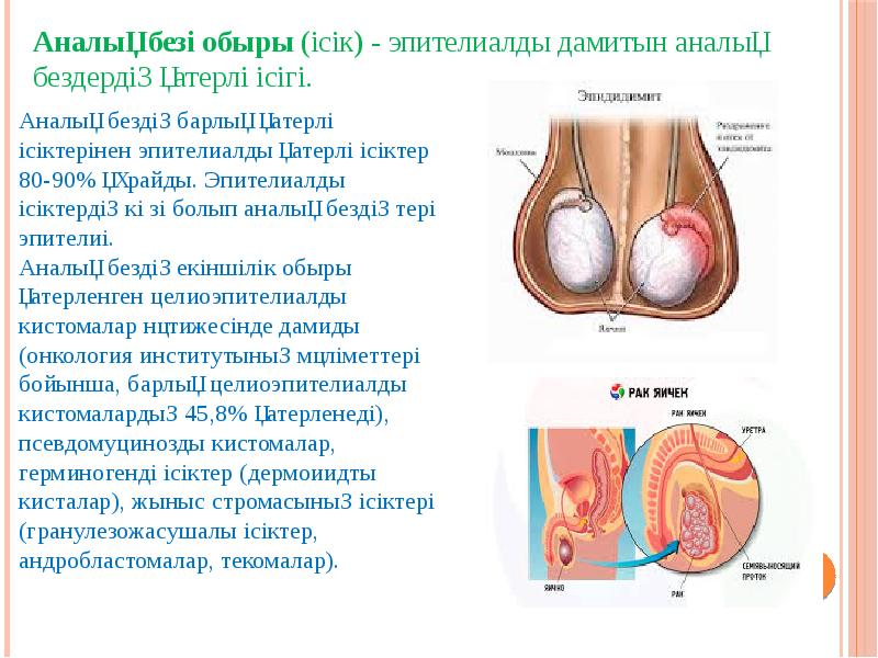 Қатерлі ісік аурулары презентация