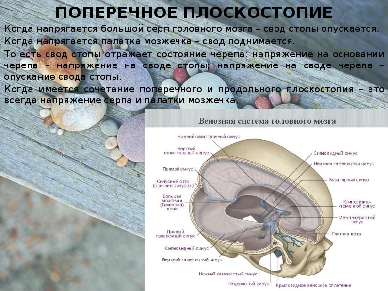 Серп большого мозга. Намет мозжечка анатомия. Вырезка намета мозжечка. Серп мозжечка. Серп мозга палатка мозжечка.