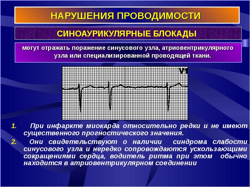 Презентация на тему осложнения инфаркта миокарда