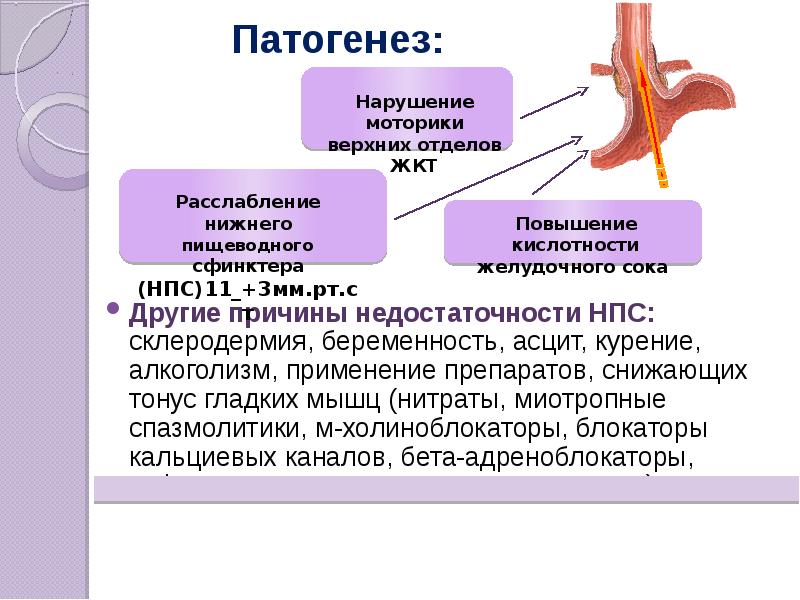 Снижение тонуса сфинктера. Патогенез диспепсии. Гастроэзофагеальная рефлюксная болезнь. Синдром желудочной диспепсии патогенез.