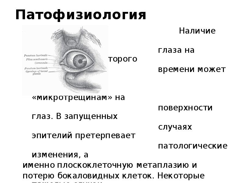 Синдром сухого глаза презентация