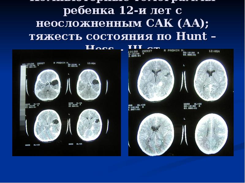 Сак кт картина