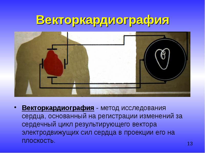 Инструментальные методы исследования сердечно сосудистой системы презентация