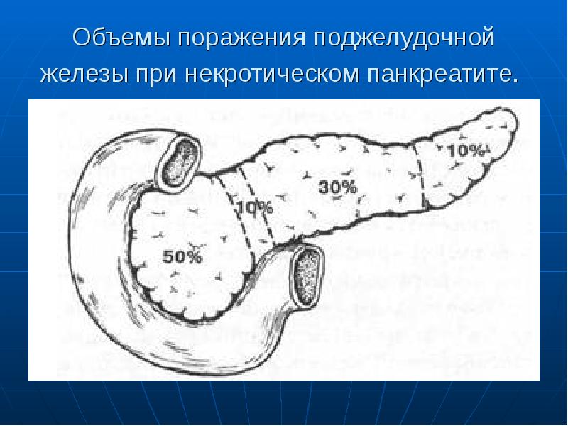 Панкреатит хирургия презентация