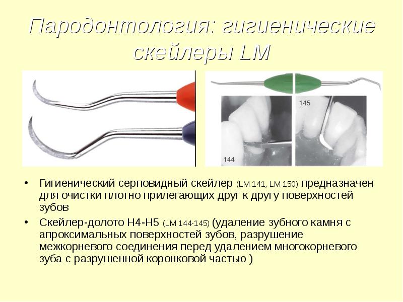 Инструменты для удаления зубов презентация