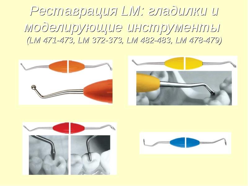 Реставрационные материалы в стоматологии презентация