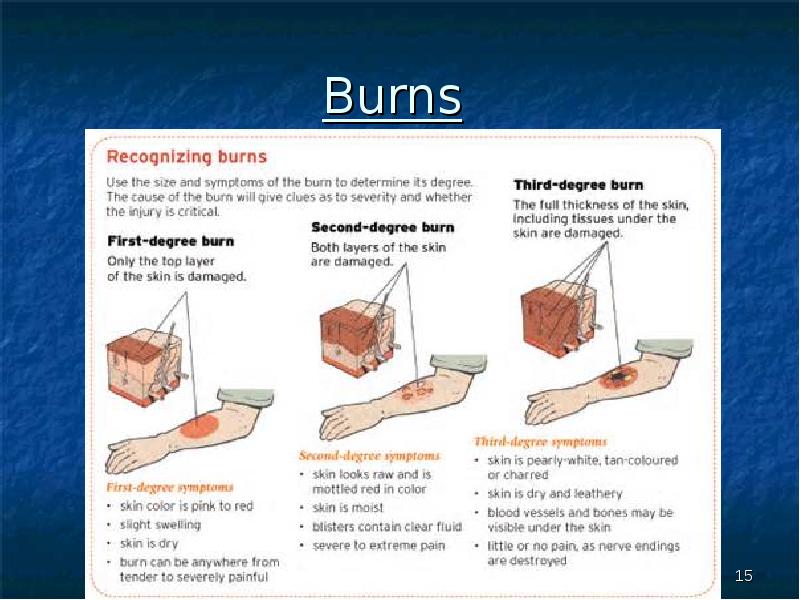 Burn ghost. Recognise Burn. Burn текст. Kitchen is Burning men. Icon causes severe Skin Burns and Eye Damage.