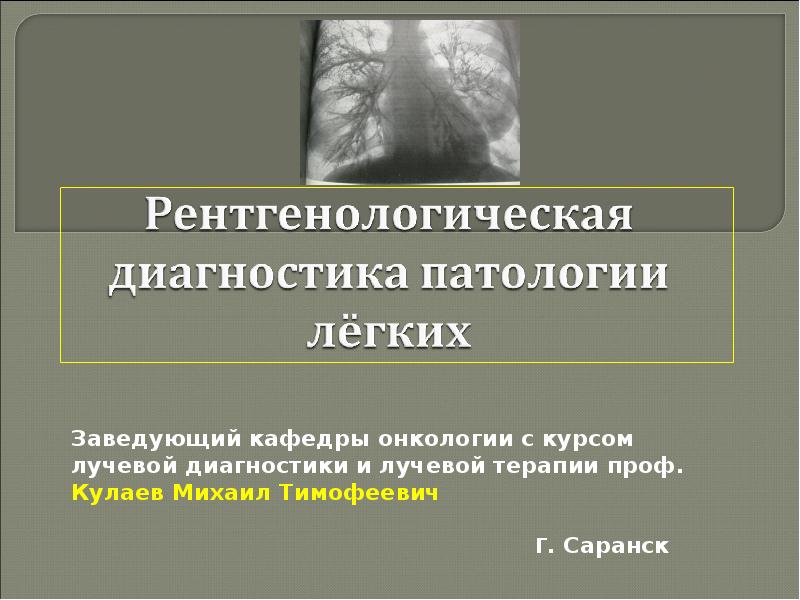 Рентгенологические синдромы заболеваний легких презентация