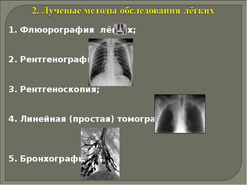Рентгенологические синдромы заболеваний легких презентация