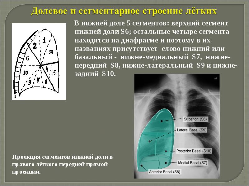 Рентгенологические синдромы заболеваний легких презентация