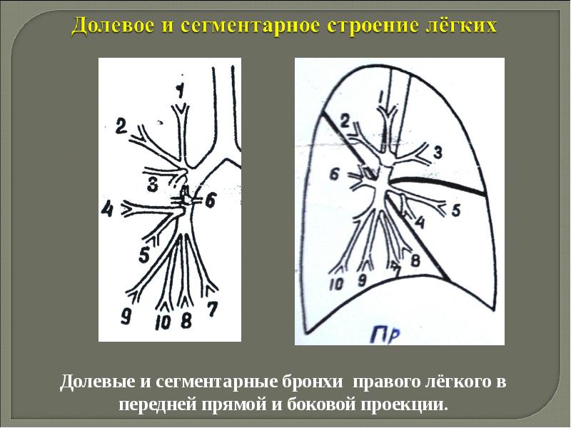 Рентгенологические синдромы заболеваний легких презентация