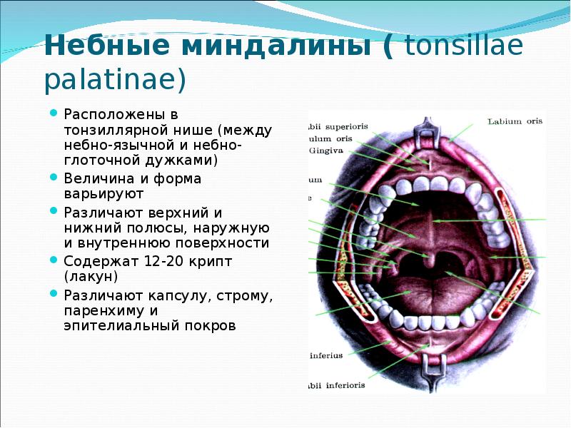 Воспаление Небной Миндалины Фото