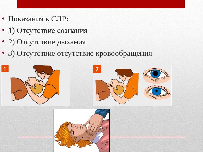 История и современность сердечно легочной реанимации презентация