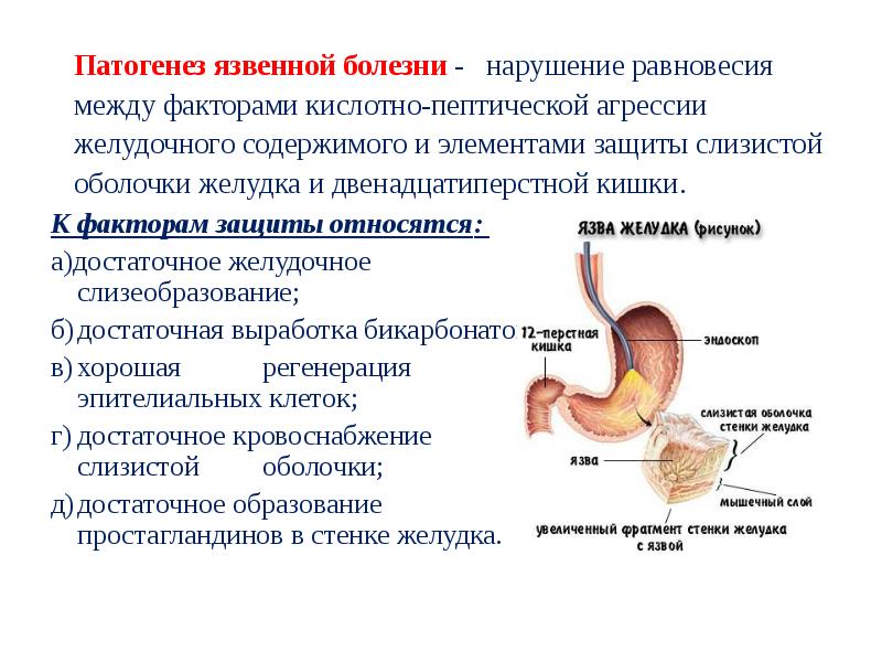 Этиология и патогенез язвенной болезни желудка презентация