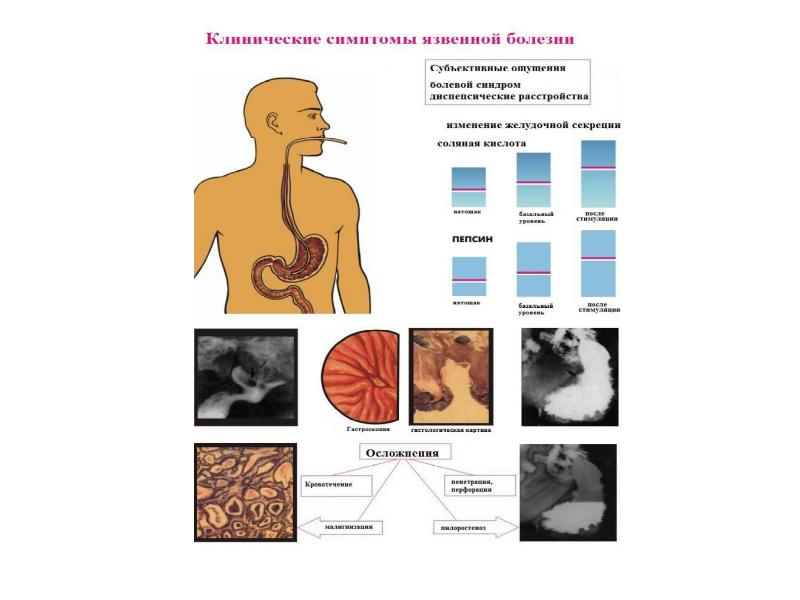 Лев заболевания. Патофизиология ЖКТ презентация. Патофизиология ротового пищеварения. Нарушение жевания патофизиология. Патофизиология ЖКТ животных.