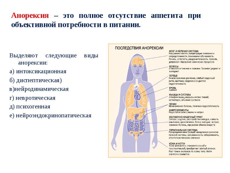 Виды анорексии