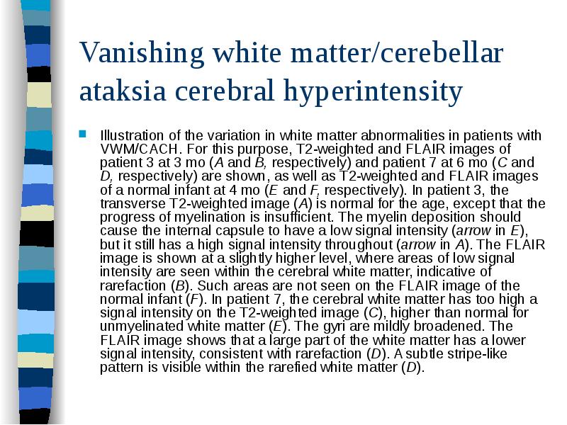 Vanishing white matter/cerebellar ataksia cerebral hyperintensity
Illustration of the variation in Vanishing white matter/cerebellar ataksia cerebral hyperintensity
Illustration of the variation in