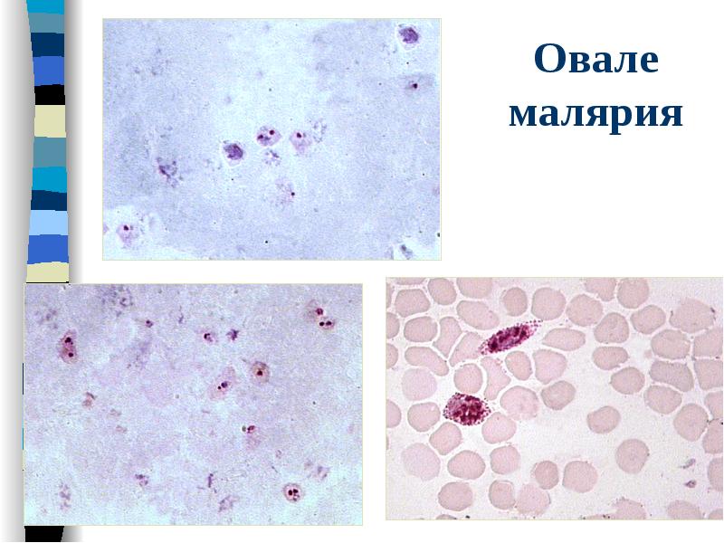 Возбудитель малярии рисунок