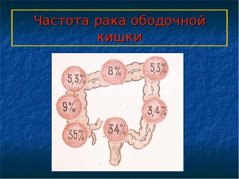 Кишечная непроходимость презентация на эту тему