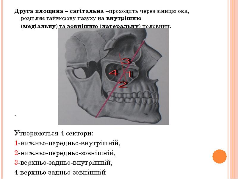 Друга площина – сагітальна –проходить через зіницю ока, розділяє гайморову пазуху Друга площина – сагітальна –проходить через зіницю ока, розділяє гайморову пазуху