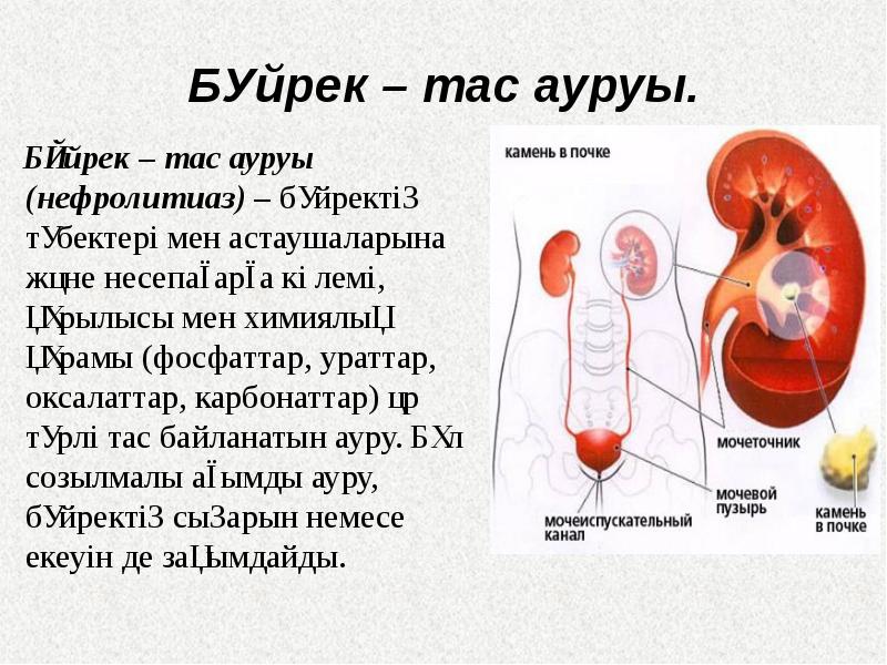 Nephrolithiasis латынь