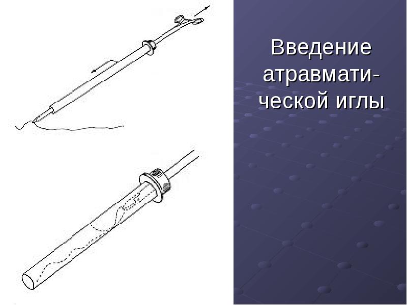 Введение атравмати-ческой иглы