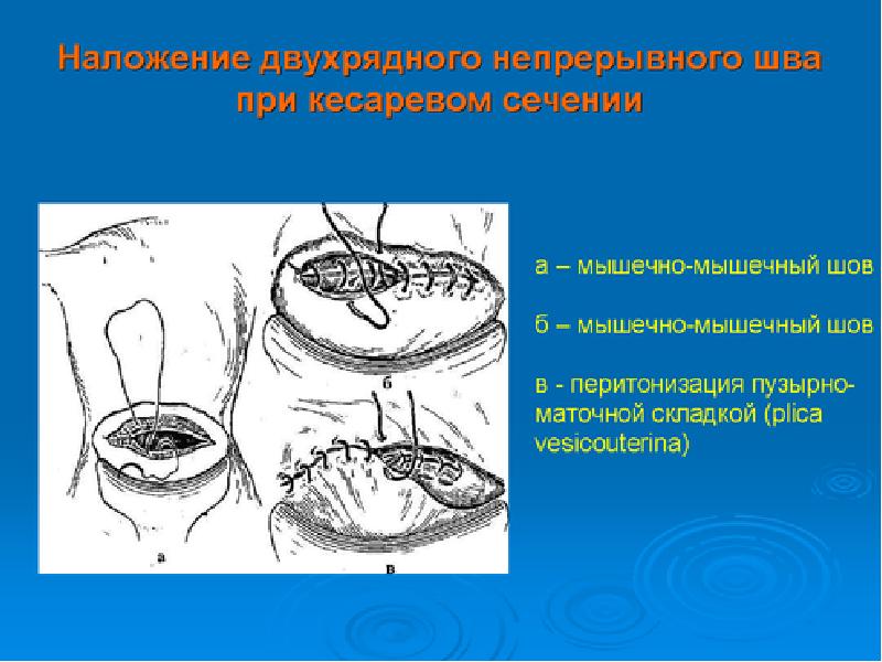 Кесарево сечение коровы презентация