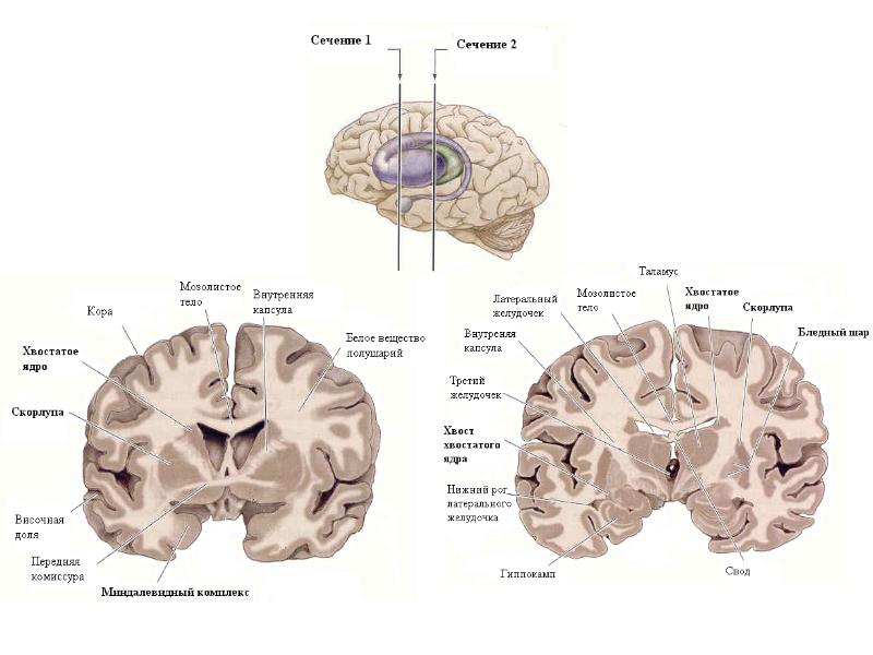 Хвостатое ядро мозга. Хвостатое ядро и скорлупа (полосатое тело). Базальные ядра конечного мозга таблица. Анатомия хвостатое ядро скорлупа. Базальные ядра мрт анатомия.