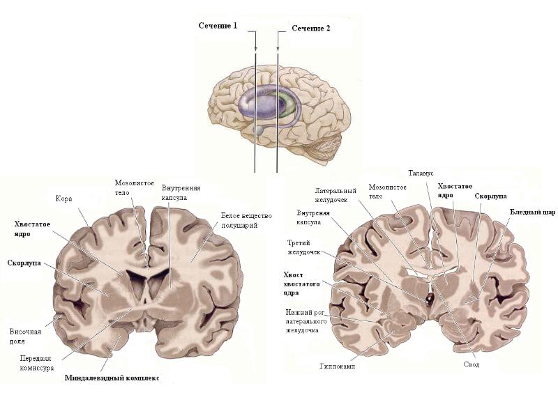 Полосатое тело мозга. Хвостатое ядро и скорлупа. Свод мозга и хвостатое ядро. Хвостатое ядро по латыни. Скорлупа анатомия латынь.