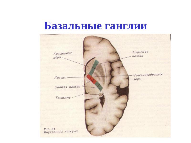 Изменение в базальных отделах. Базальные ганглии и внутренняя капсула. Базальные ядра мозга строение. Хвостатое ядро в базальных ганглиях. Базальные ганглии структура.