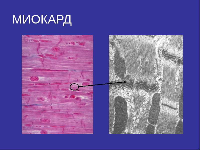 Миокард гистология рисунок
