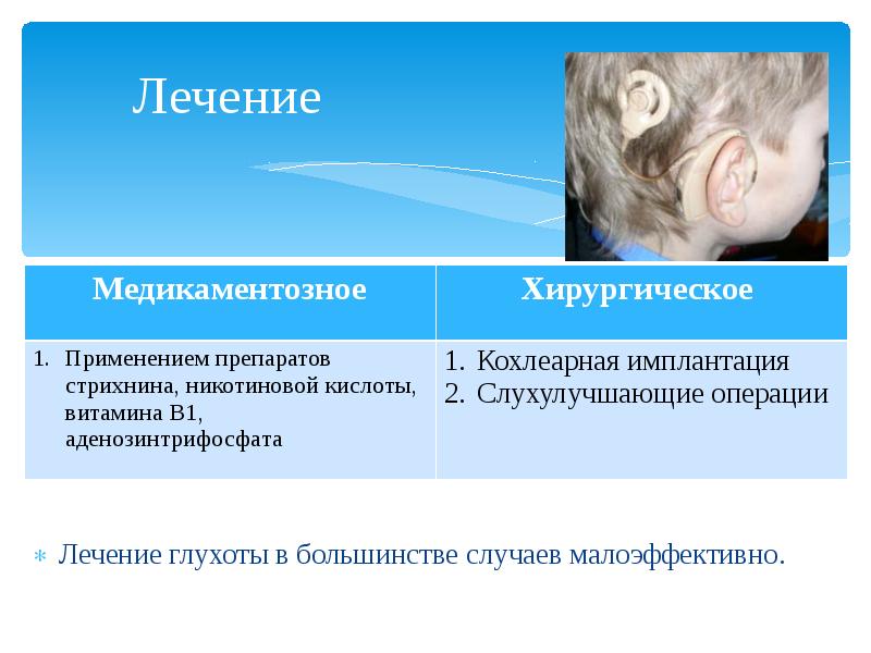 Глухота аномалия. Причины глухоты. Симптомы глухоты у ребенка. Причины глухоты у детей. Профилактика глухоты.