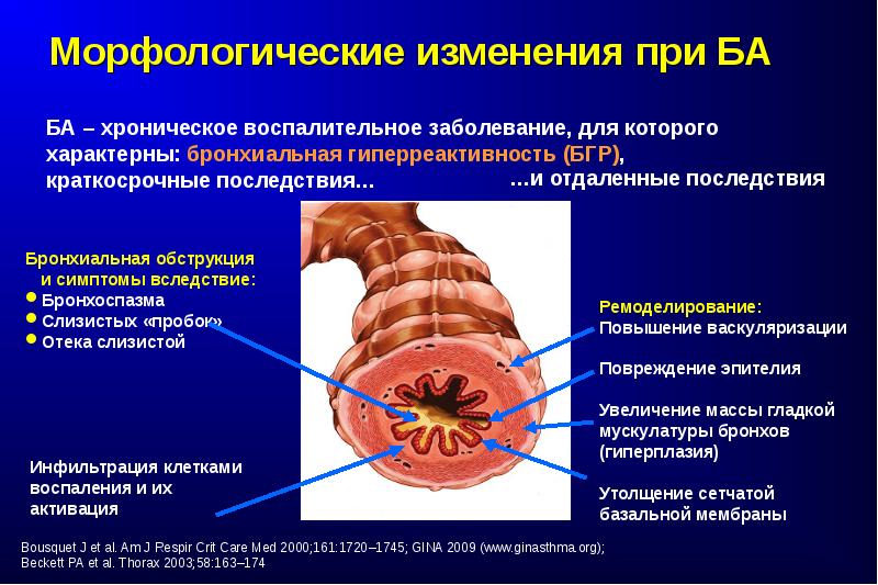 Школа больного бронхиальной астмой презентация